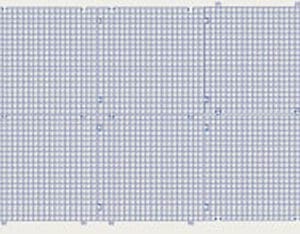 CSG-Six Waffle Grid Surface